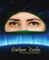 MİLLİTV.AZ: “İlahi Möcüzəli Rentgen Qadın” – Zərifə Mayılova